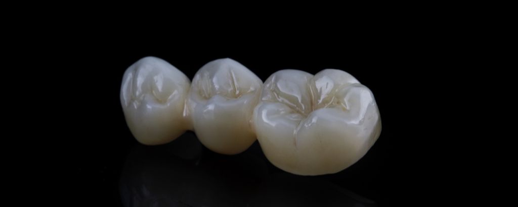 高松市の審美歯科なら吉本歯科医院 |ジルコニア